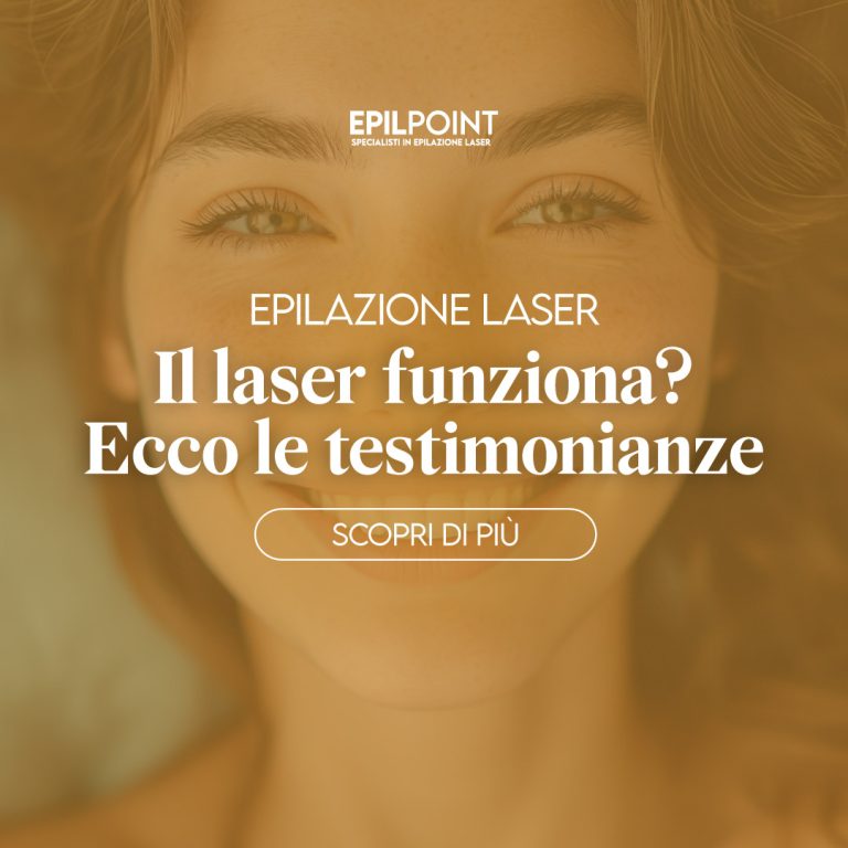 epil point recensioni